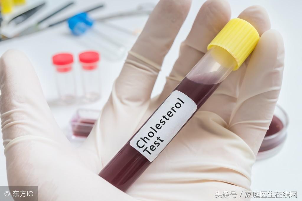 糖尿病的成因，深度解析其背后的原因，深度解析糖尿病成因，揭示背后原因真相