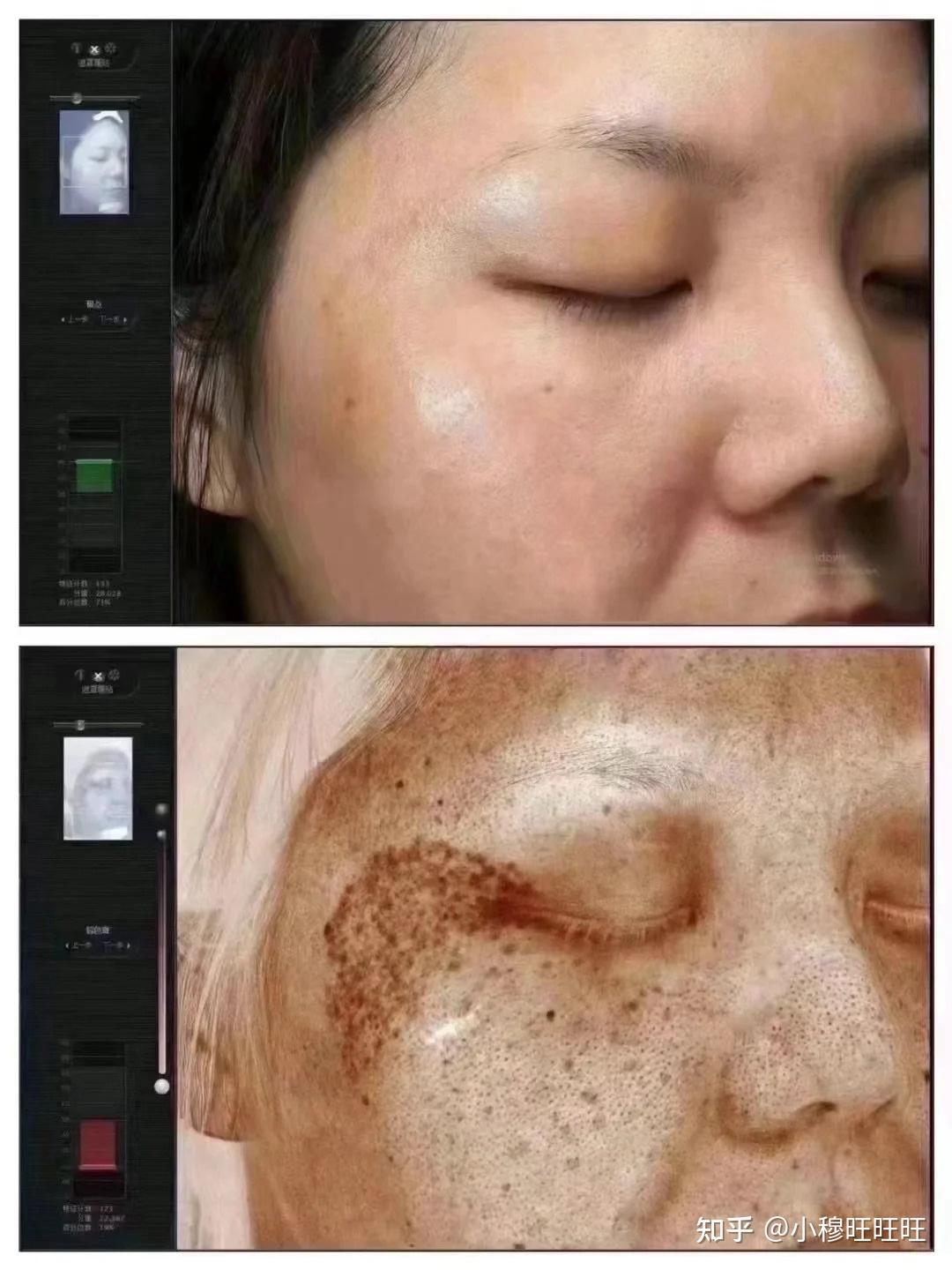 激光祛斑，選擇醫(yī)院還是美容院？全面解讀助您做出明智決策，激光祛斑，如何選擇醫(yī)院與美容院？全面解讀為您指明決策方向