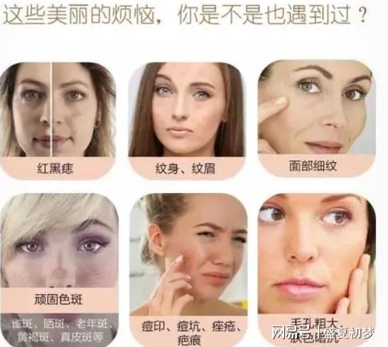 激光祛斑真害人？深度解析激光祛斑的利與弊，深度解析，激光祛斑的利弊與潛在風(fēng)險(xiǎn)揭秘