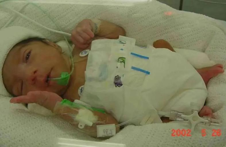 萎縮性胃炎患者的壽命預(yù)期，了解、管理與展望，萎縮性胃炎患者的壽命預(yù)期，理解、管理與未來展望