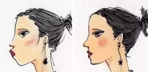 鼻子整形后能否永久保持？全面解析鼻子整形手術(shù)的持久性，鼻子整形手術(shù)的持久性與永久保持的可能性解析