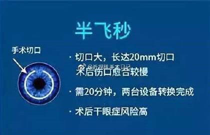 全飛秒和半飛秒哪個更好，深度解析兩種近視矯正技術(shù)的優(yōu)劣，全飛秒與半飛秒近視矯正技術(shù)對比，深度解析優(yōu)劣差異
