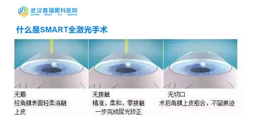 晶體植入近視手術(shù)的利與弊，全面解析與深度探討，晶體植入近視手術(shù)的利與弊，全面解析與深度探討深度探討及解析近視手術(shù)晶體植入利弊